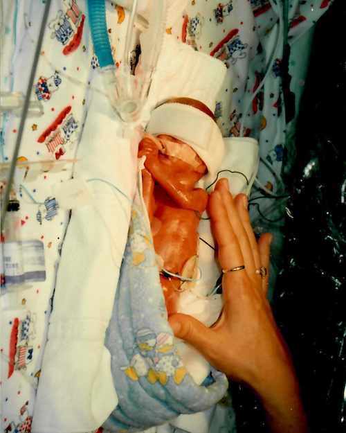 Newborn baby in an incubator, with a hand gently holding the baby's arm during medical care in a hospital setting.