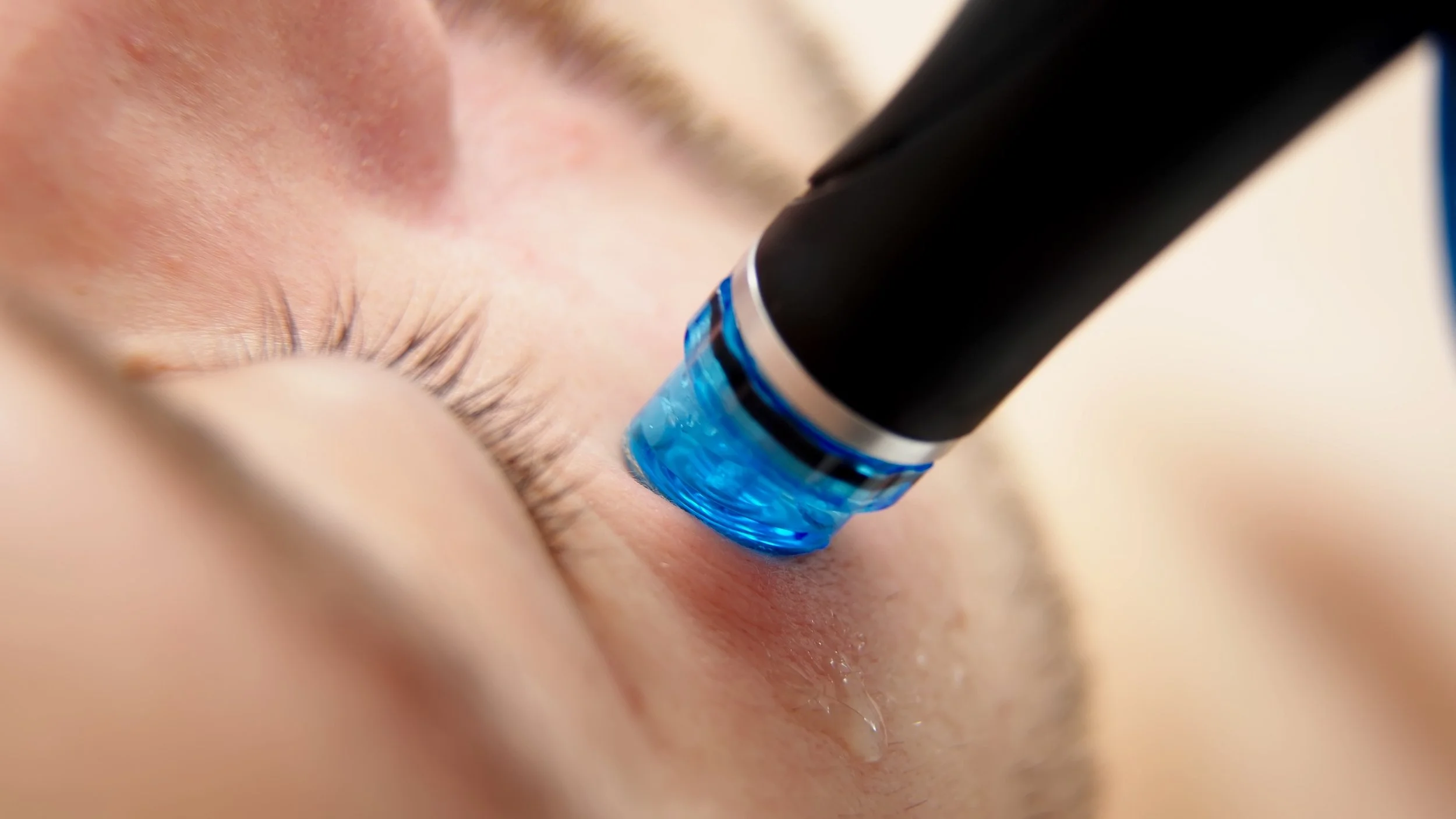 Medspa in Fremont, CA, 94555 HydraFacial Near Me