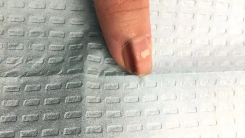Pre-treatment