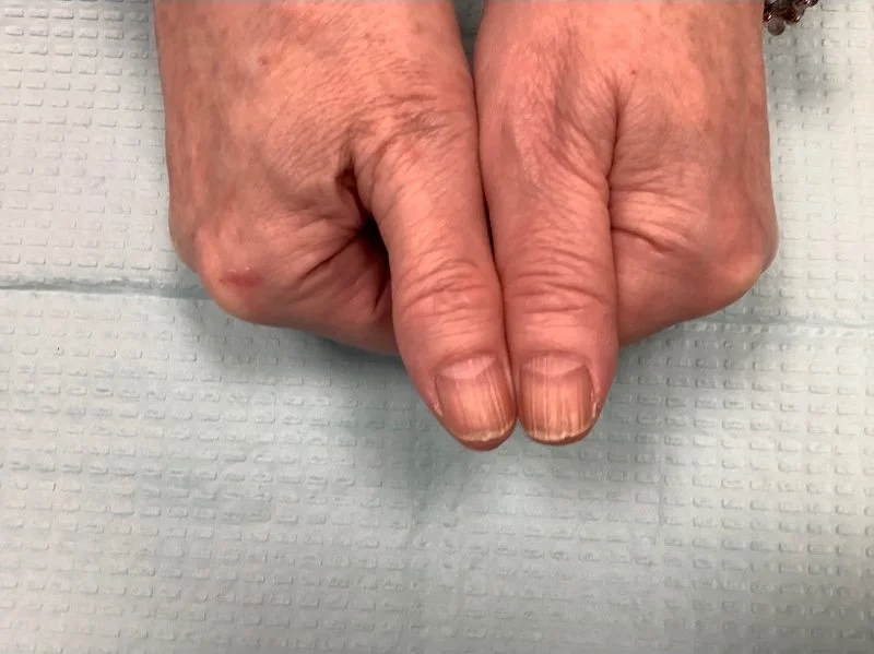 Pre-treatment