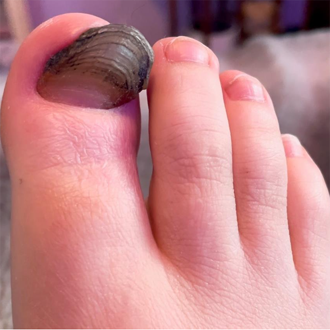 Pre-treatment