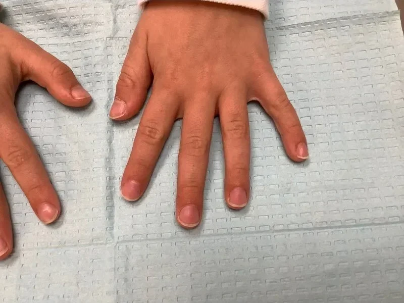 Post-treatment