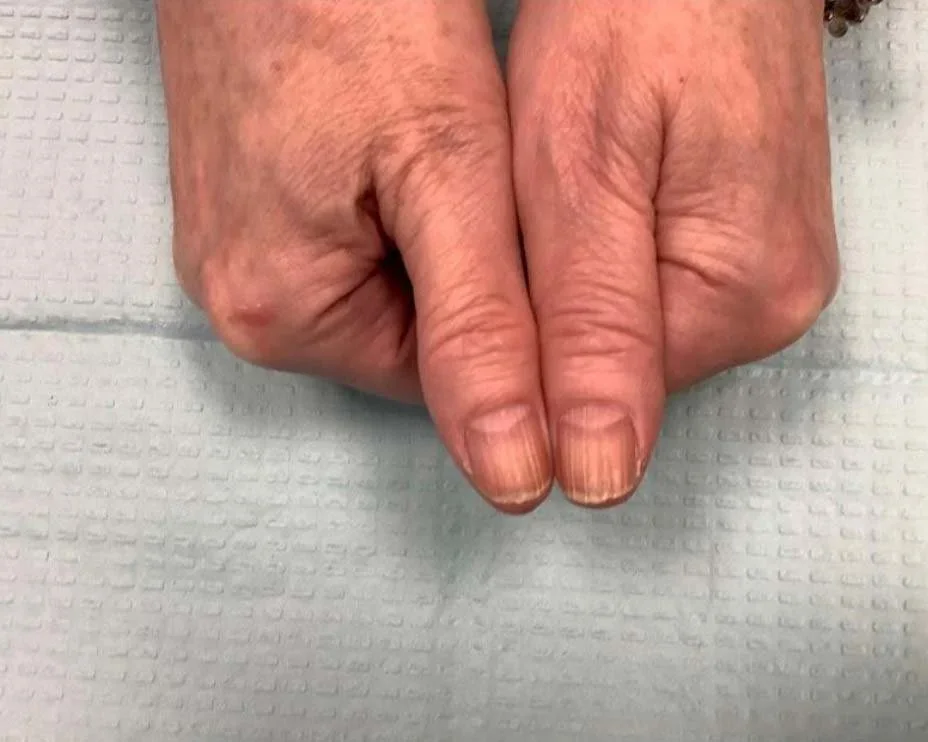 Pre-treatment