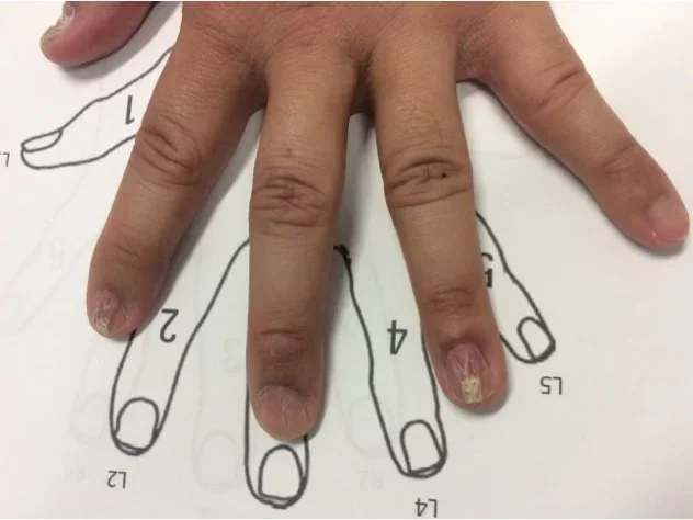 Pre-treatment