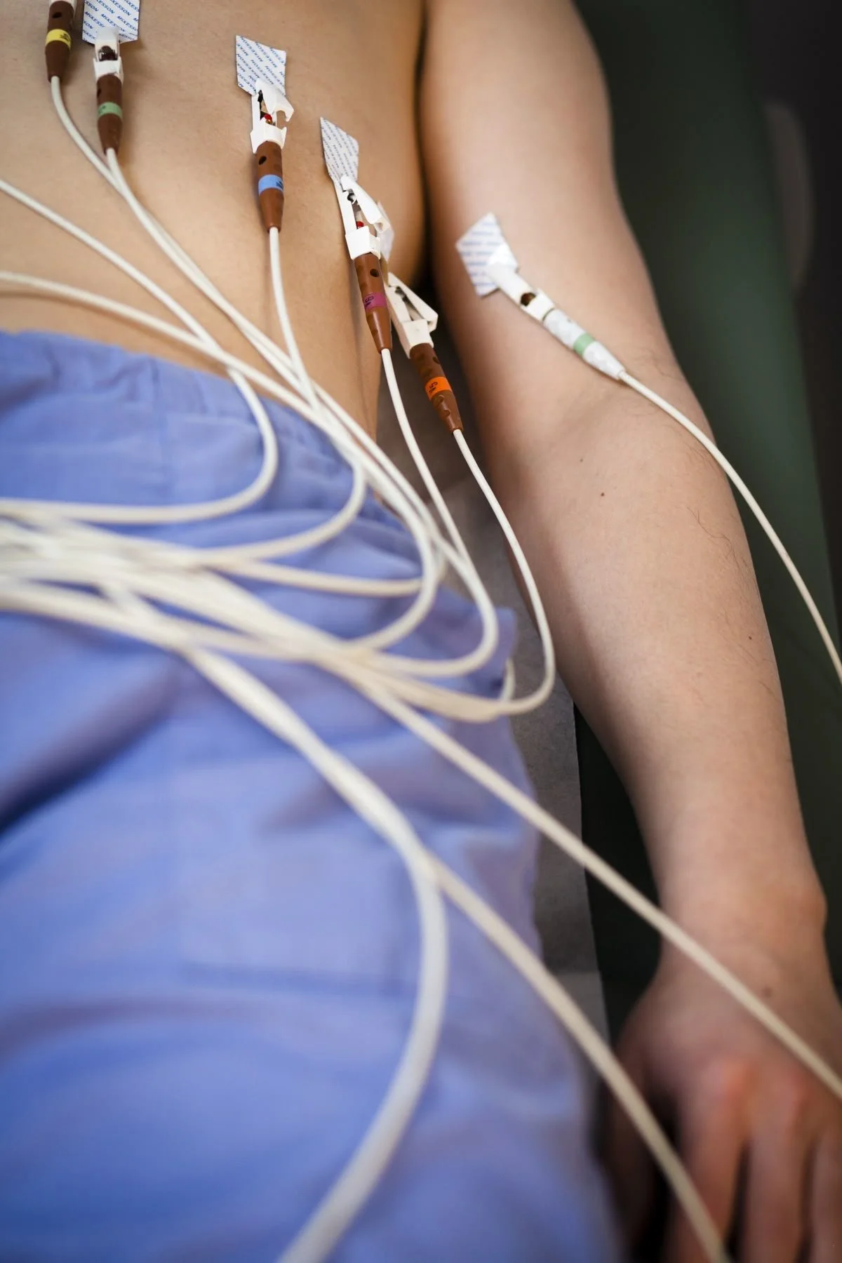 Resting ECG