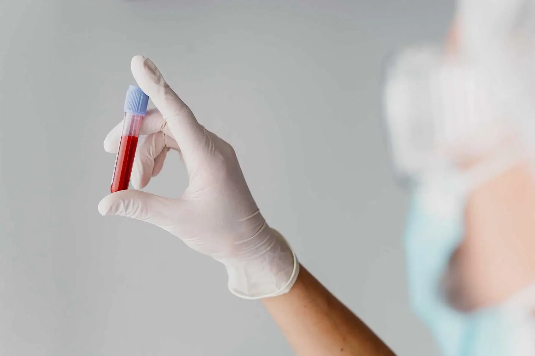 Standard Blood Test