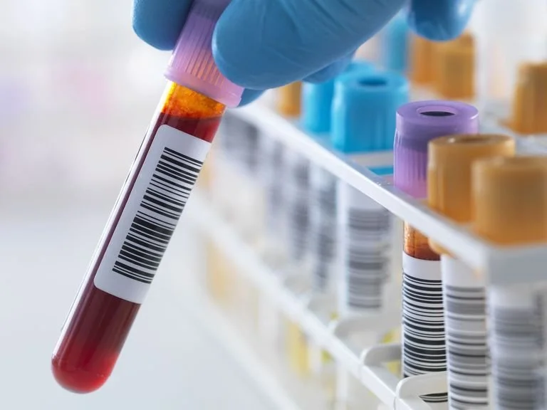 Regular Fortnightly Blood Test