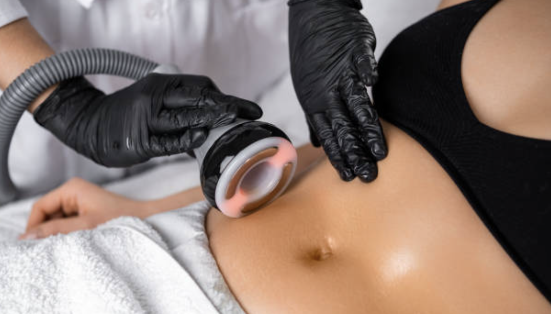 A person receiving a Vacuum & RF treatment with a handheld device on their abdomen, while another person wearing black gloves operates the device.