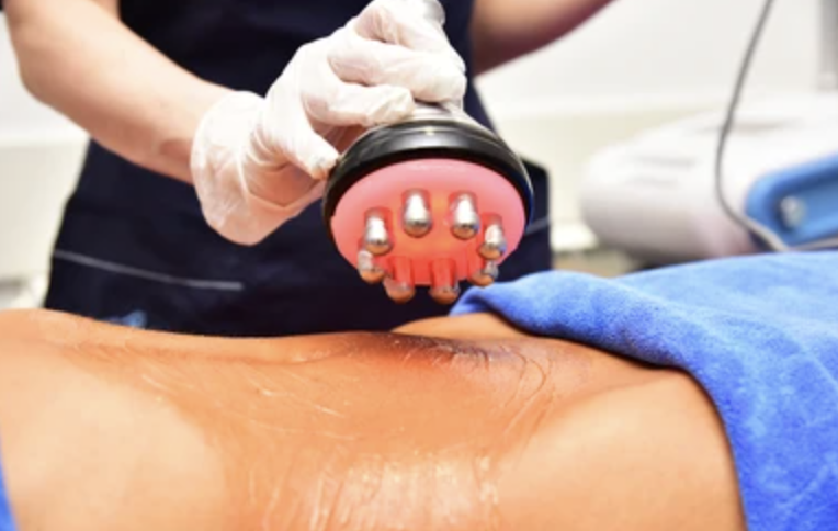 Certified Body Contouring Specialist using Radio Frequency Therapy device on a patient's abdomen.