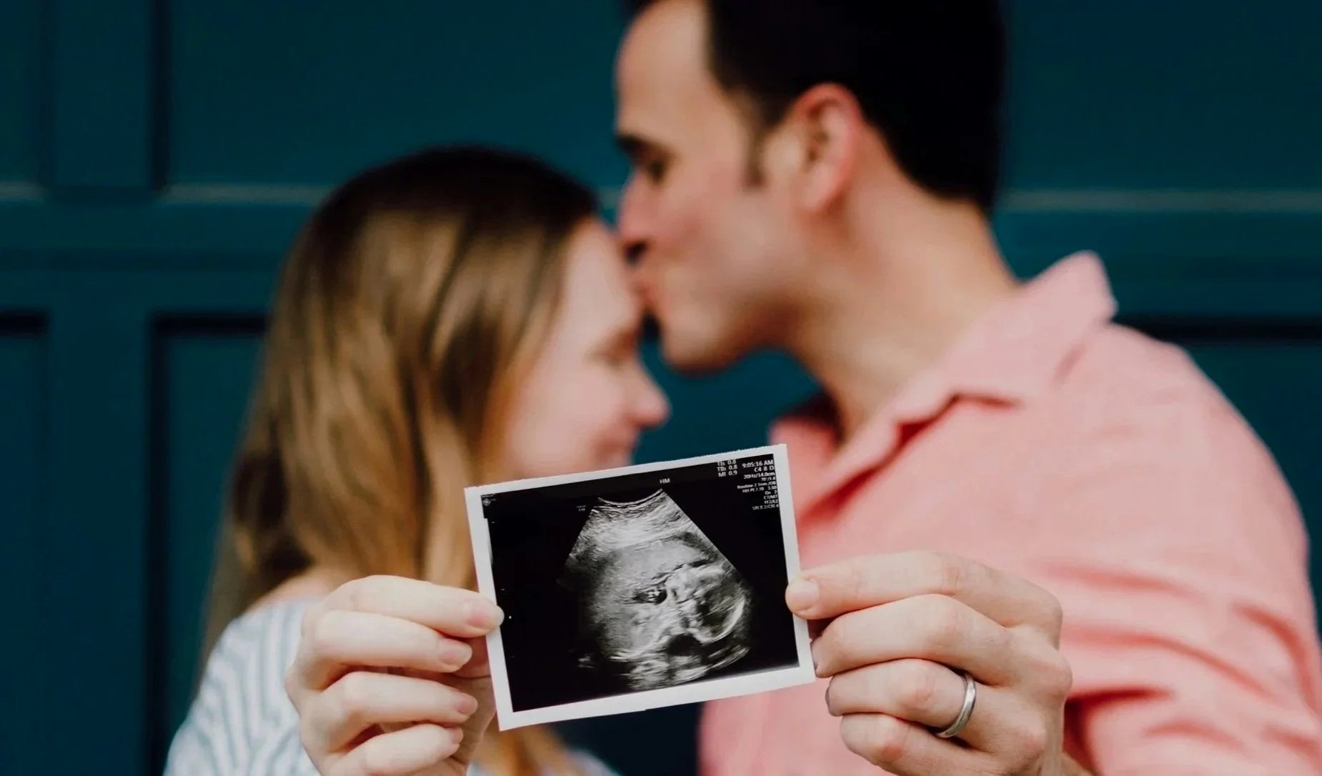 A couple is holding an ultrasound picture of a baby while sharing a kiss.