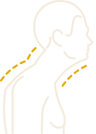 Trouble postural