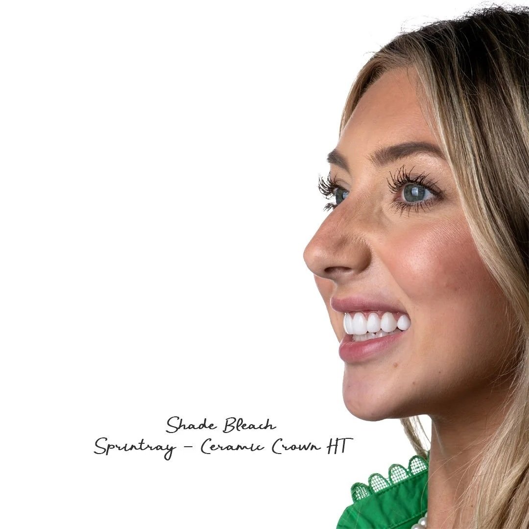 Close-up of a smiling woman with blonde hair and blue eyes, wearing a green top, with text 'Shade Bleach Spruntray - Ceramic Crown HT' at the bottom.