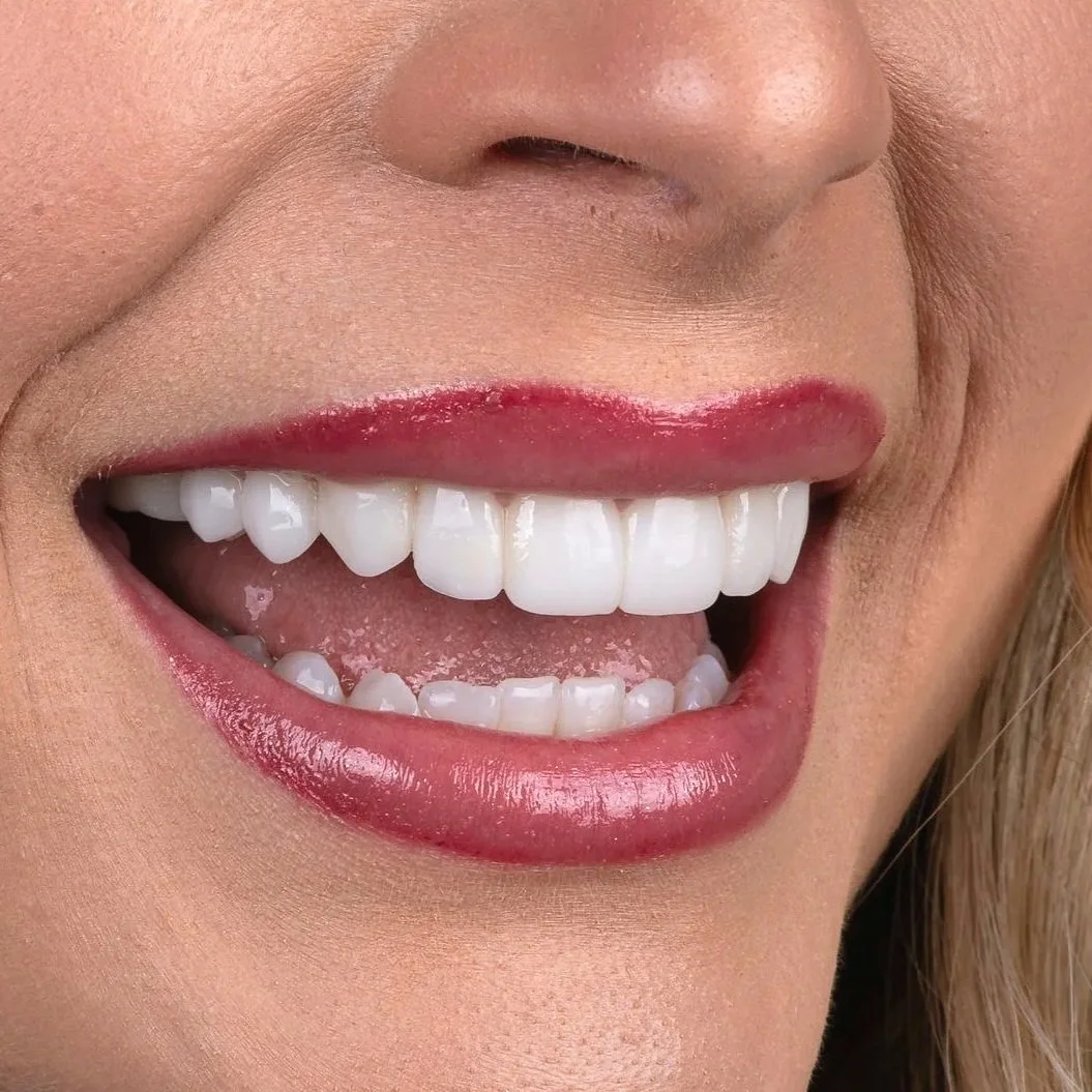 A close-up of a person's smiling mouth showing white teeth, with pink lipstick, and the person's nose and a part of their cheek visible.