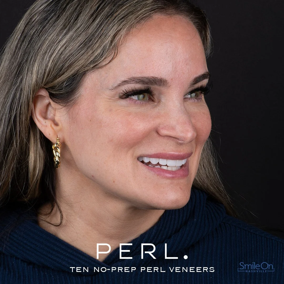 Close-up portrait of a smiling woman with light brown hair, wearing gold earrings and a dark blue top, against a black background. Text overlay reads 'PERL. TEN NO-PREP PERL VENEERS' and the logo 'SmileOn Nashville' in the bottom right corner.