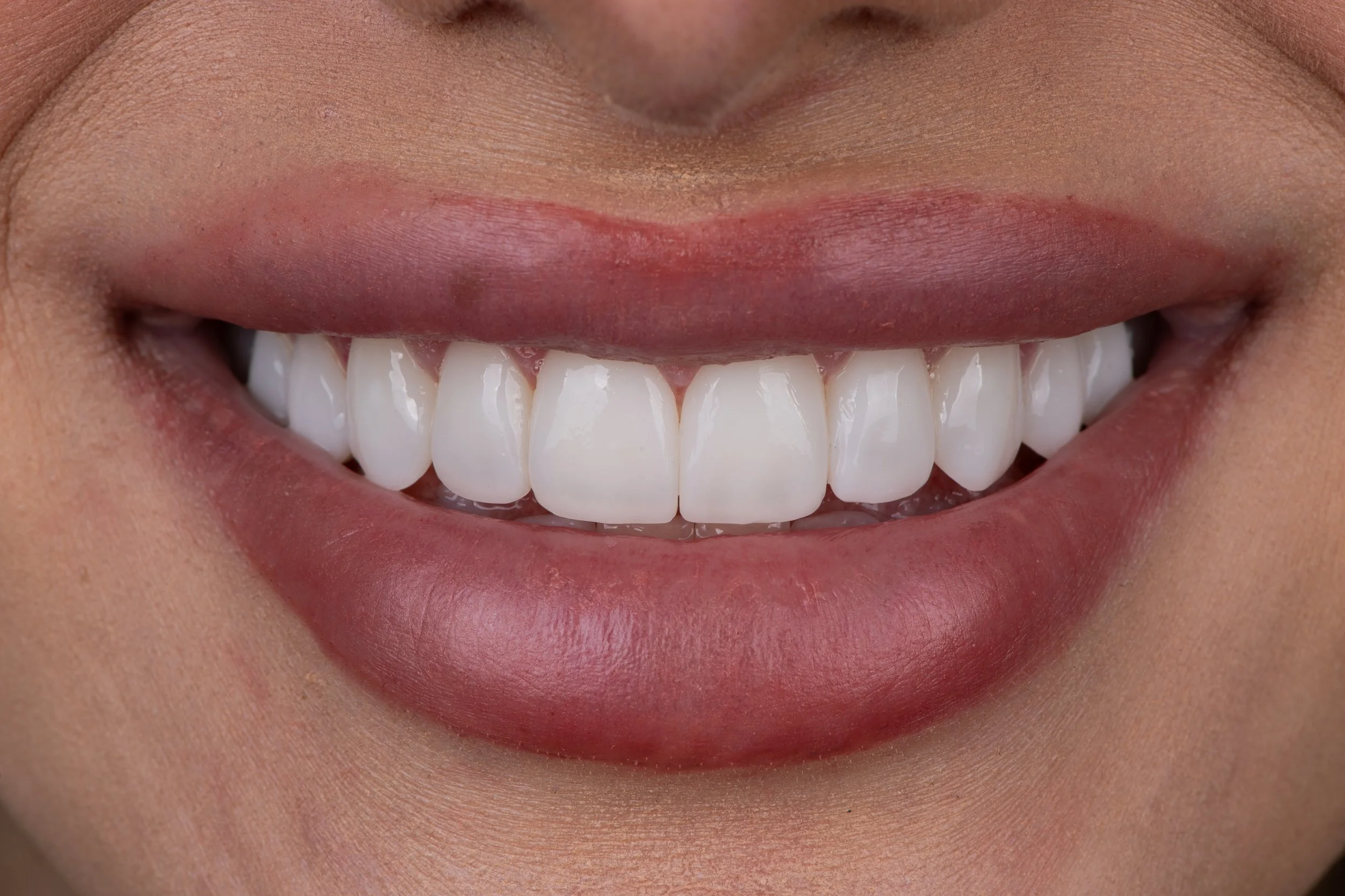 final-photo-perl-printed-smile-on-nashville