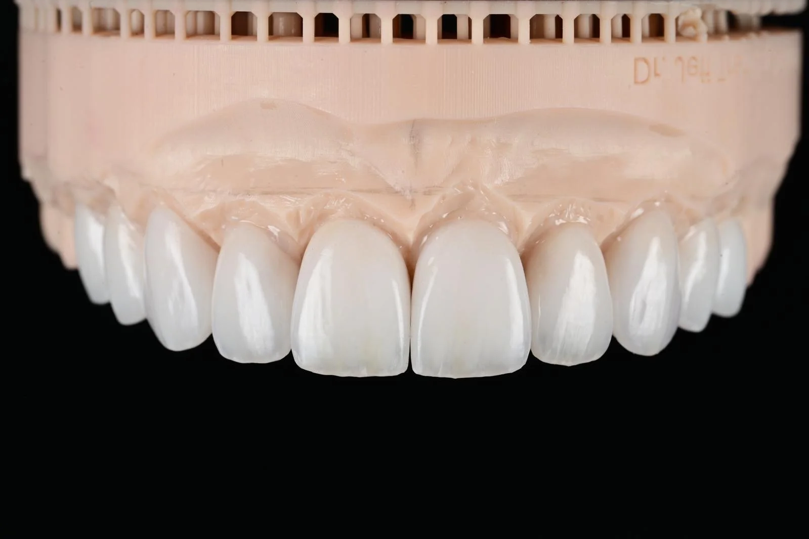 A dental prosthetic set of upper teeth, showing white, artificial teeth attached to a pink base, displayed on a black background.