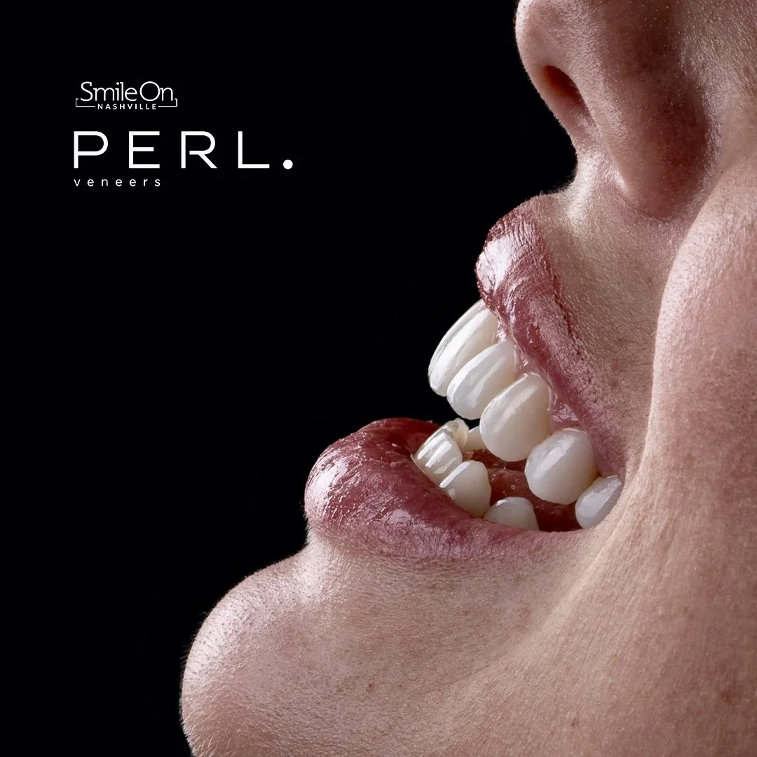 Close-up of a person's mouth with red lipstick, showing white teeth and part of their nose against a black background, with text advertising Pearl veneers by SmileOn Nashville.