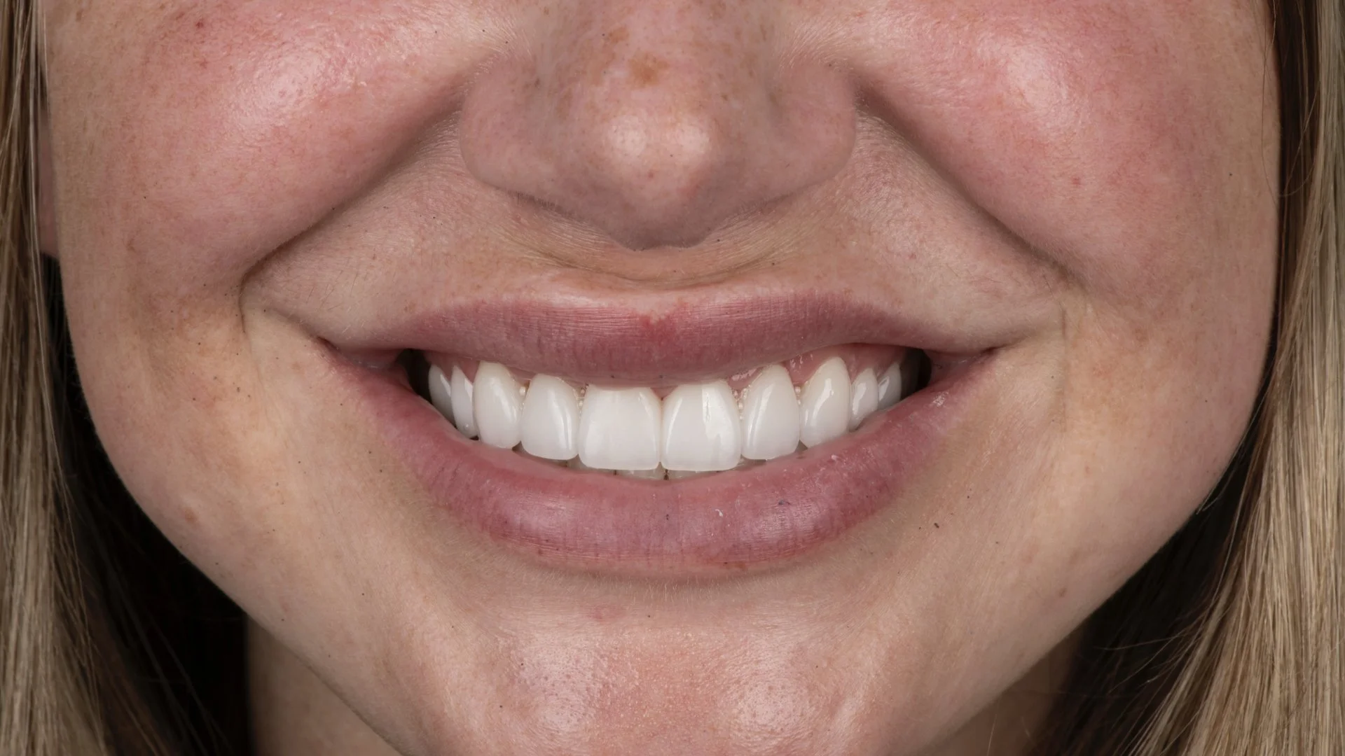 Close-up of a smiling woman showing her white teeth.