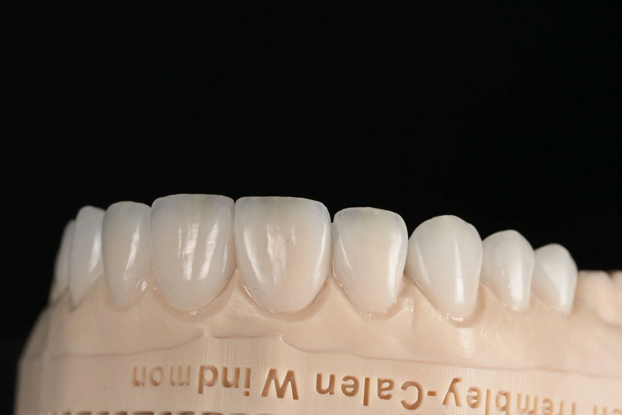 Close-up of a dental model showing artificial teeth on a black background.