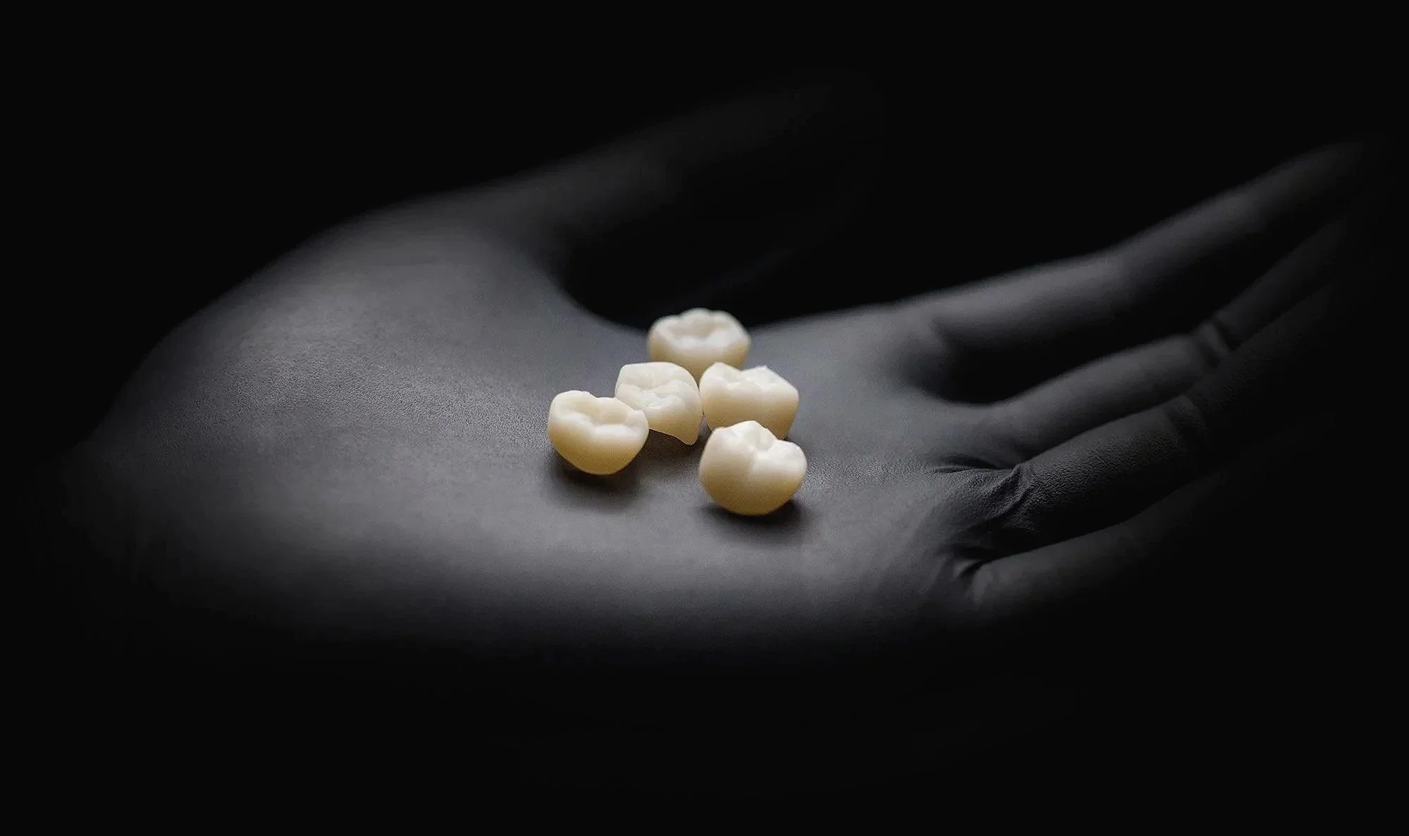 A hand wearing a black glove is holding a few white dental crowns.