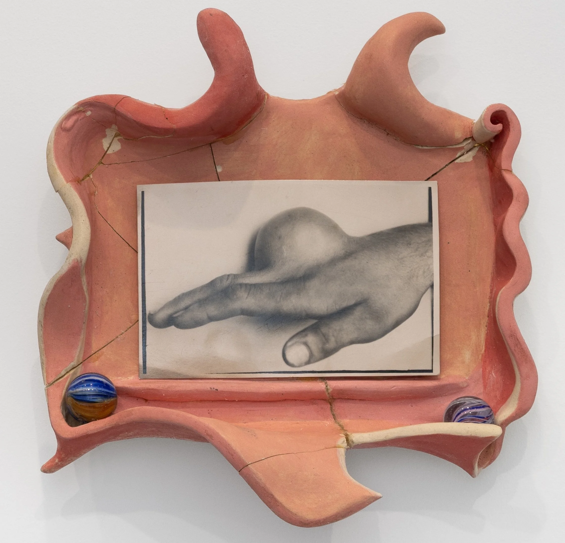 Bobby Walsh
Untitled (Hand Tumor), 2024