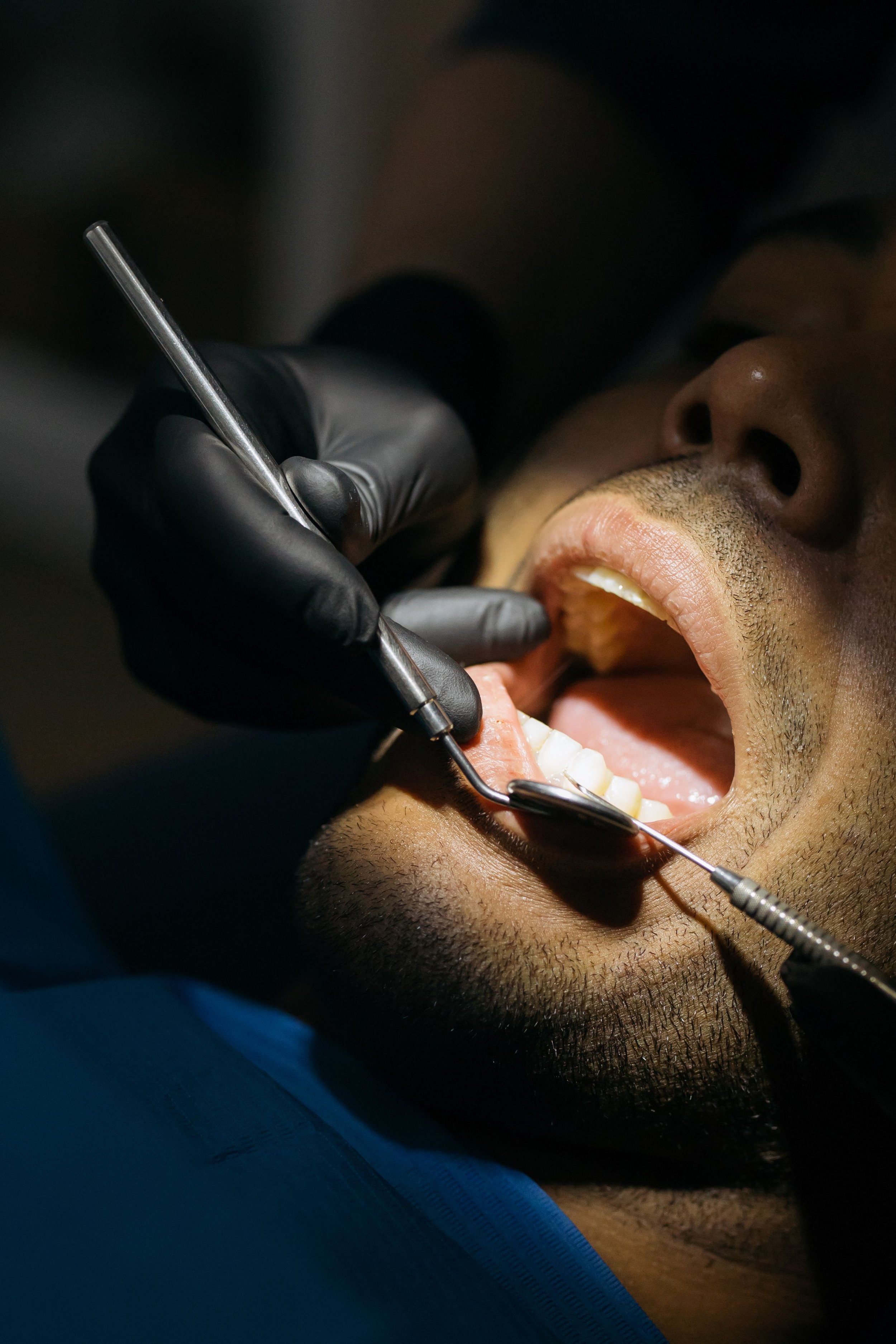 Dental Cleaning and Disease Prevention Tacoma Wa