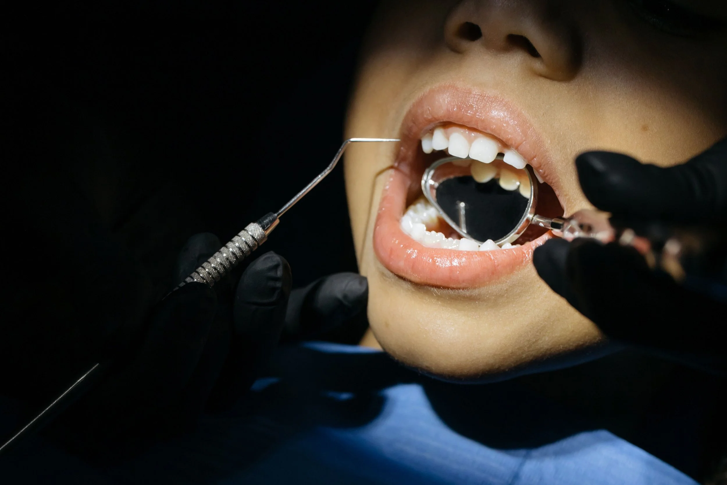 Close-up of a person's open mouth during a dental check-up, with dental tools and dental mirror visible, and a dark background.