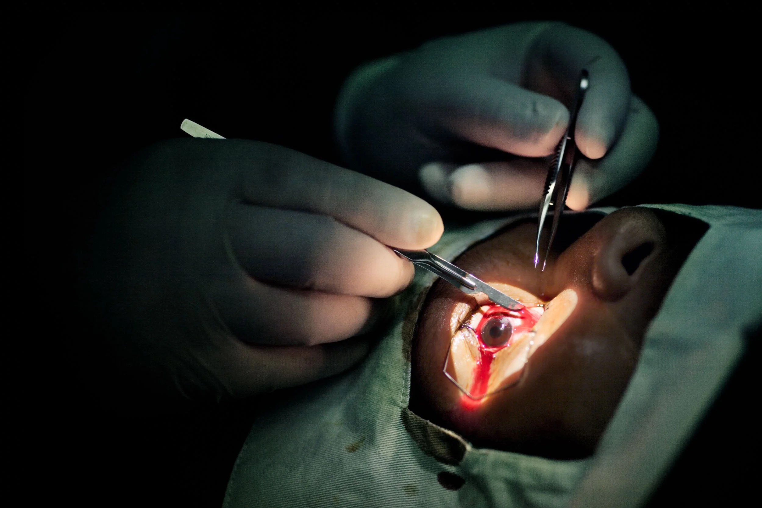 Eye_SurgeryLayersUScropped.jpg