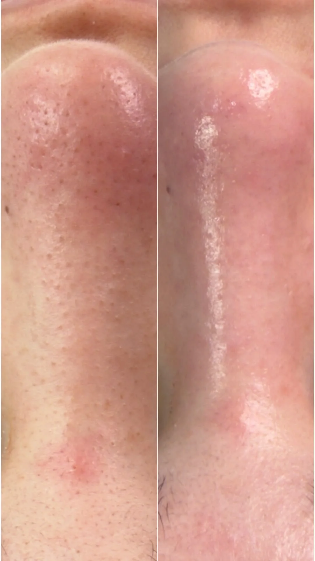 A woman with dark hair and multiple earrings relaxing with closed eyes at a spa or salon, getting a facial treatment.