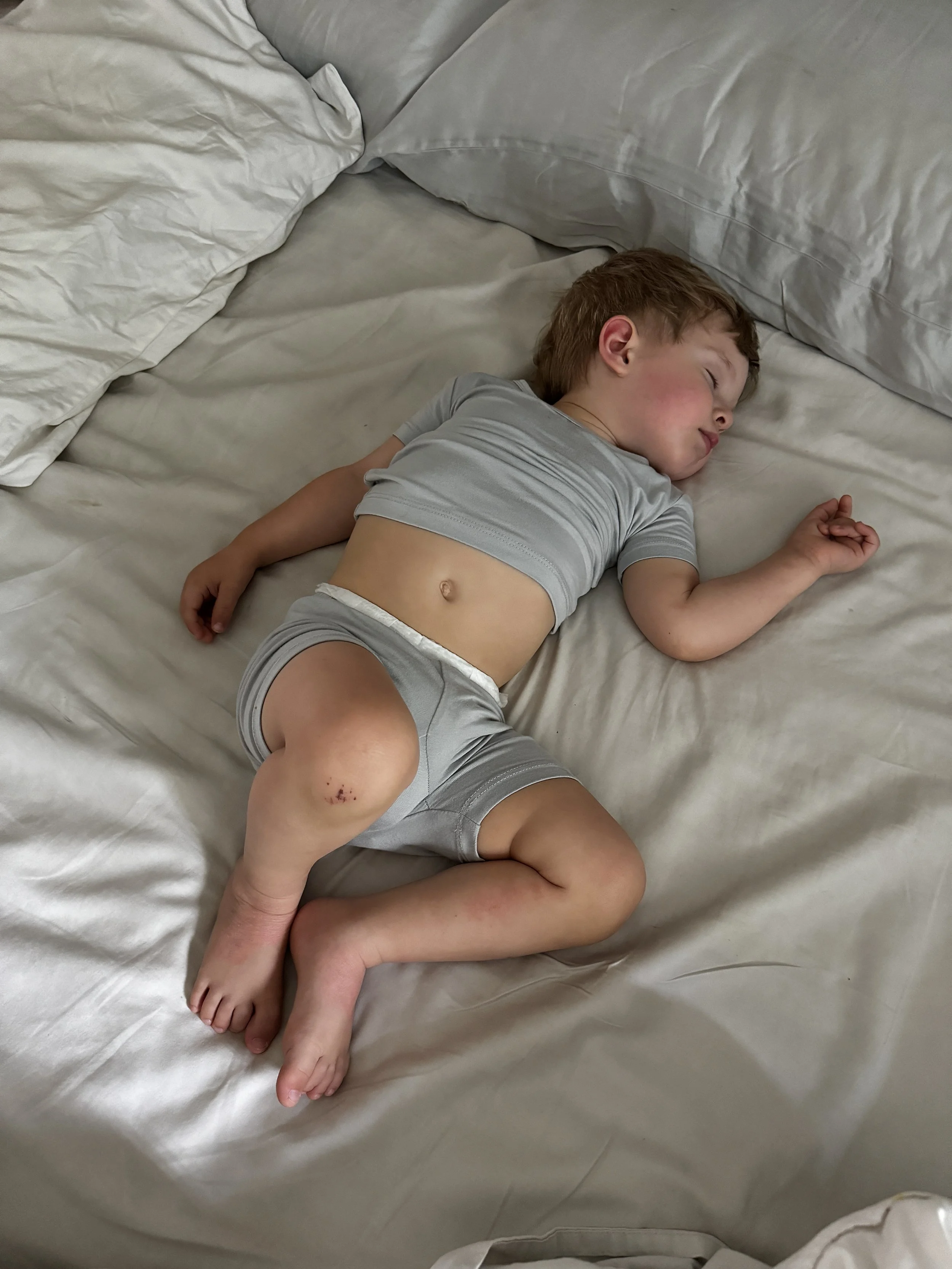 A young boy with light skin and brown hair is sleeping on a bed with white sheets and pillows. He is dressed in a gray t-shirt and gray shorts, with one knee slightly bent. There is a small scrape or bruise on his right knee.