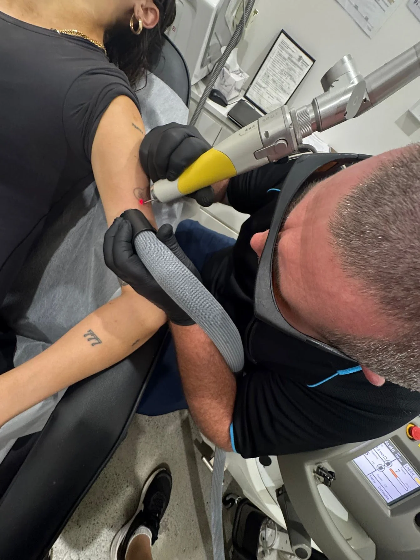 A medical professional performs a laser tattoo removal procedure on a person's arm in a clinical setting. The technician uses a handheld laser device, and the person receiving treatment is lying on a medical bed wearing glasses.