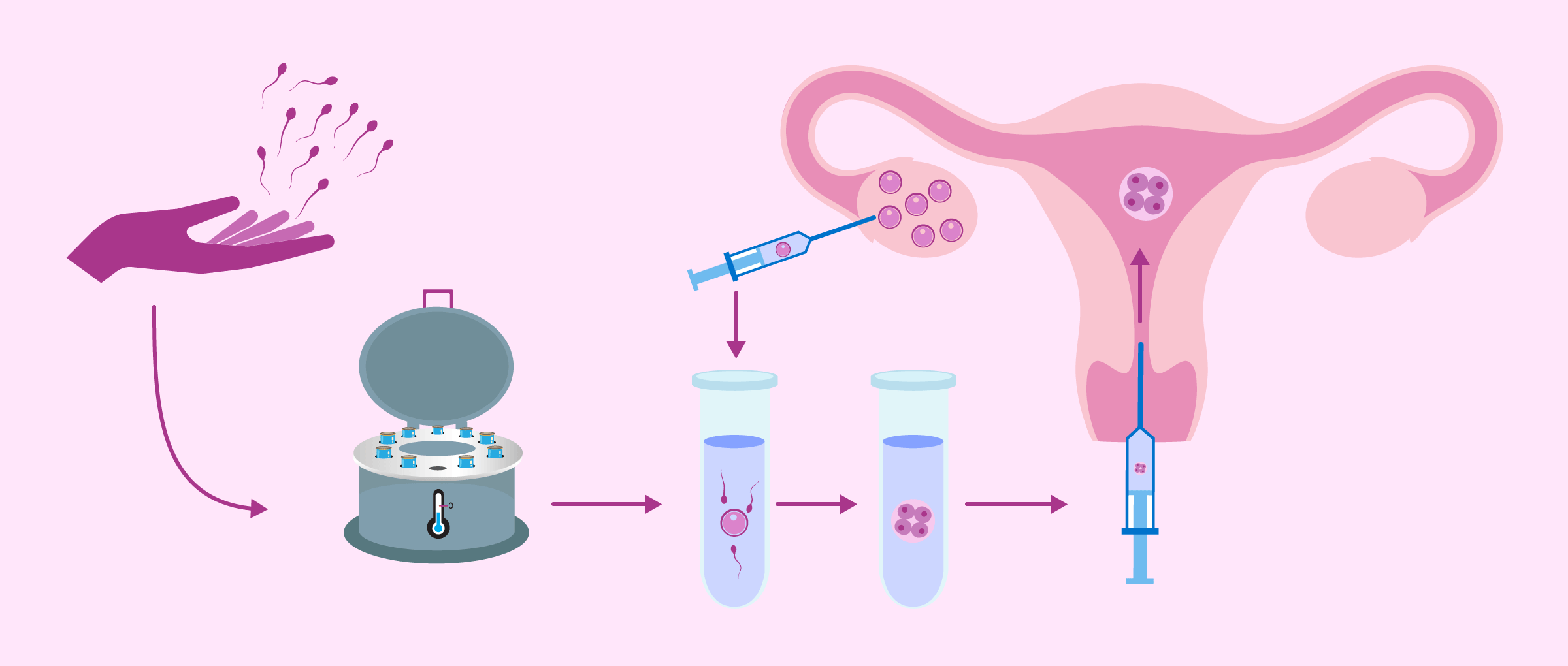 Donor Sperm Process at Life Fertility Clinic Sydney