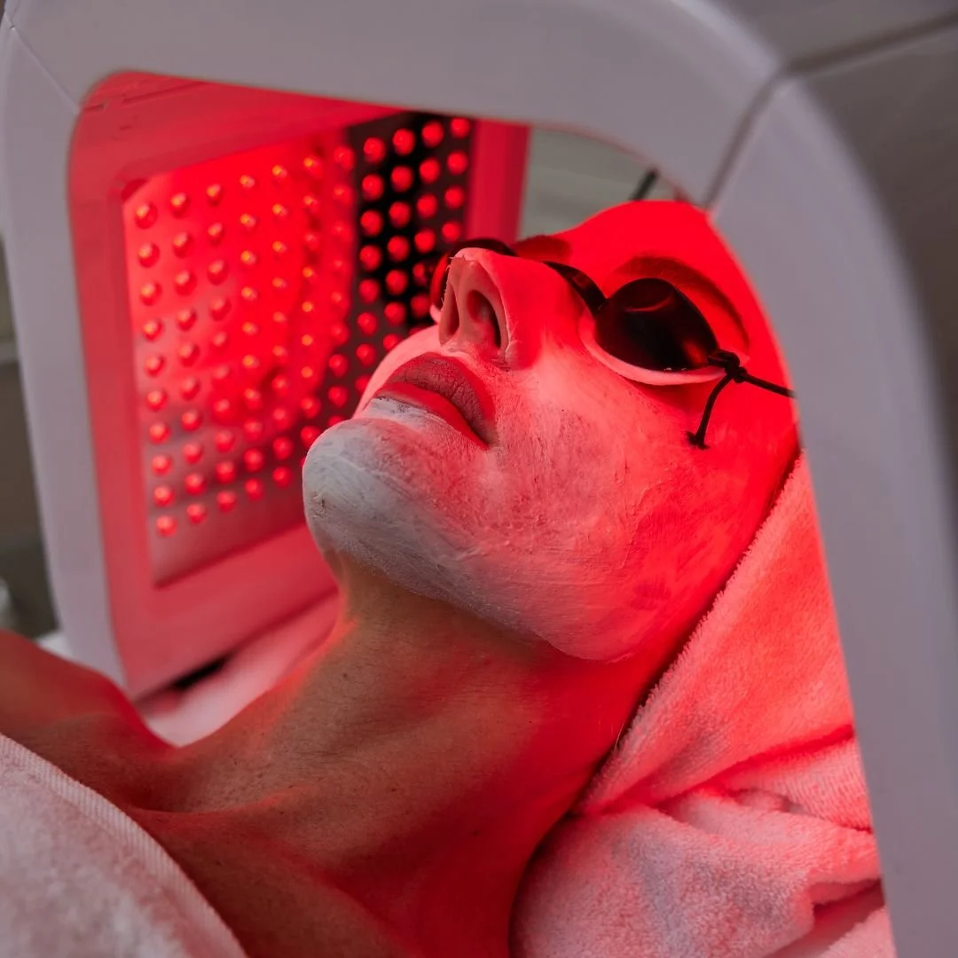 Client wearing protective goggles during red LED facial skin therapy