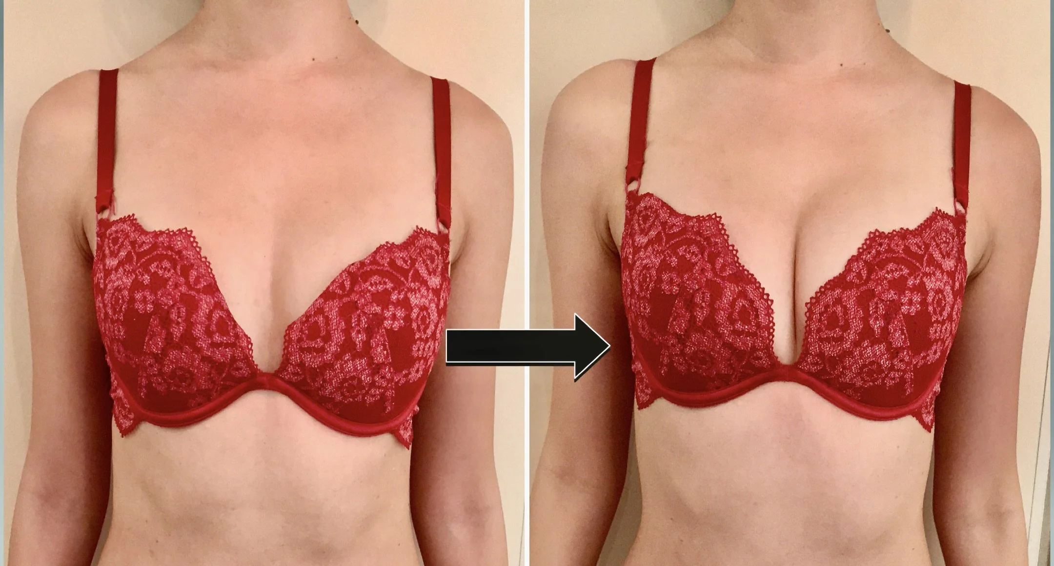 BeforeAfter 32 2.jpeg