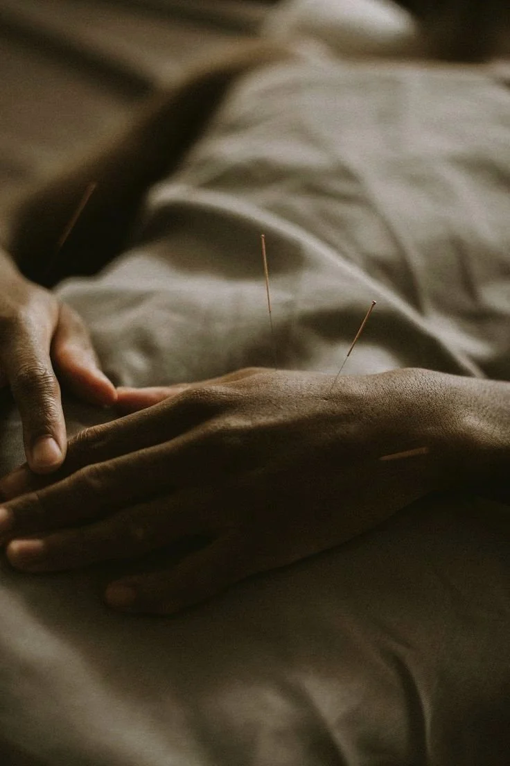 Person receiving acupuncture treatment