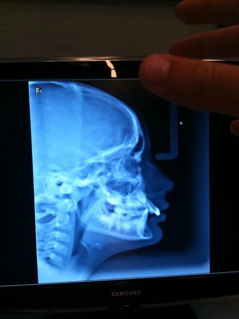 Brad's X-ray