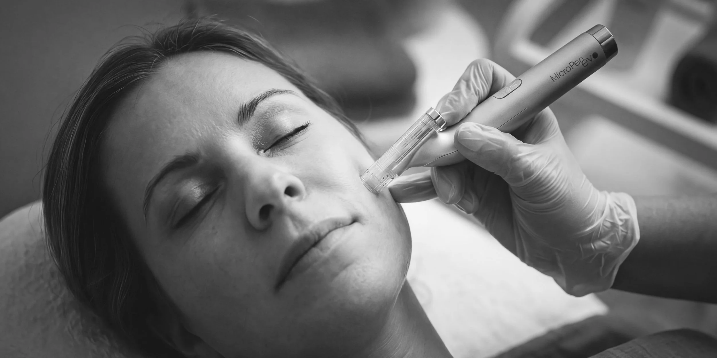 A woman lying down with eyes closed receives a cosmetic treatment to her face from a professional wearing gloves, holding a device labeled 'MicroPeel' near her cheek.