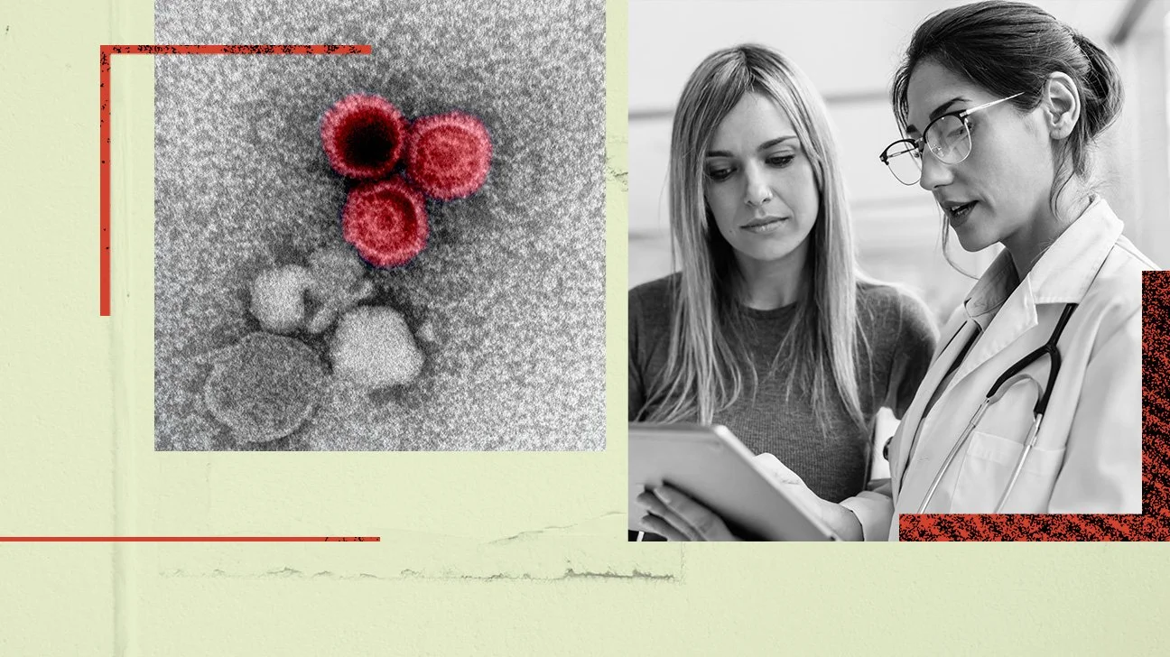 Epstein-Barr-lupus-collage-1296x728-header.jpg