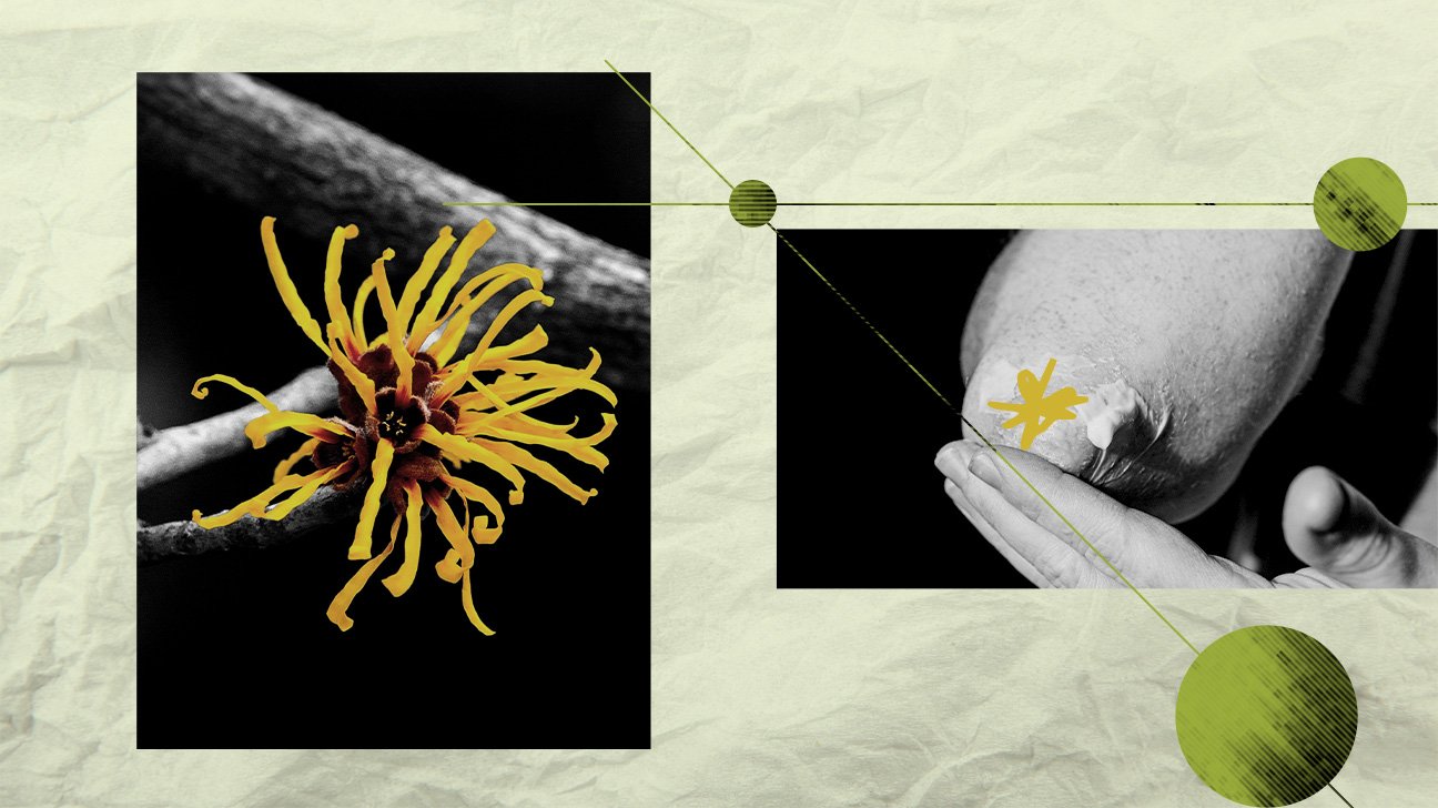 witch-hazel-psoriasis-collage-1296x728-header.jpg