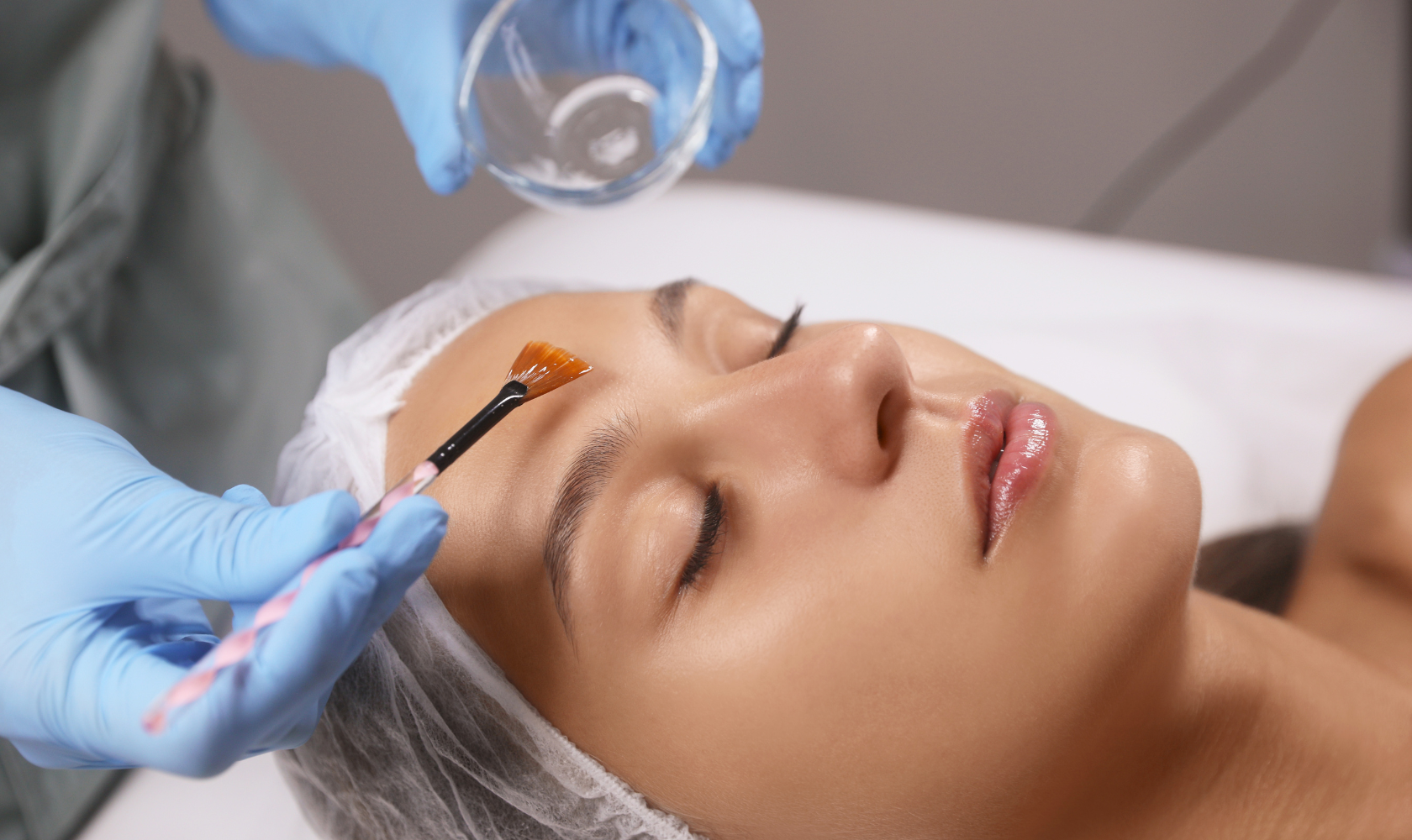 Medspa in Hollywood, FL, 33020  Chemical Peels Near Me