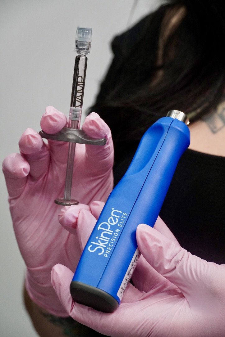 Medspa in Hollywood, FL, 33020 Microneedling Near Me