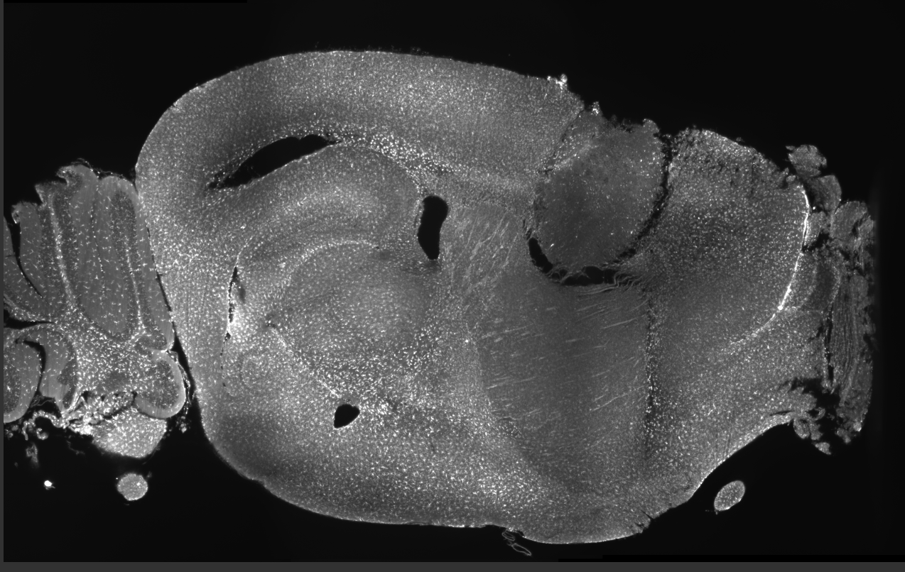 Microscopic view of a biological specimen, showing cellular structures in black and white.