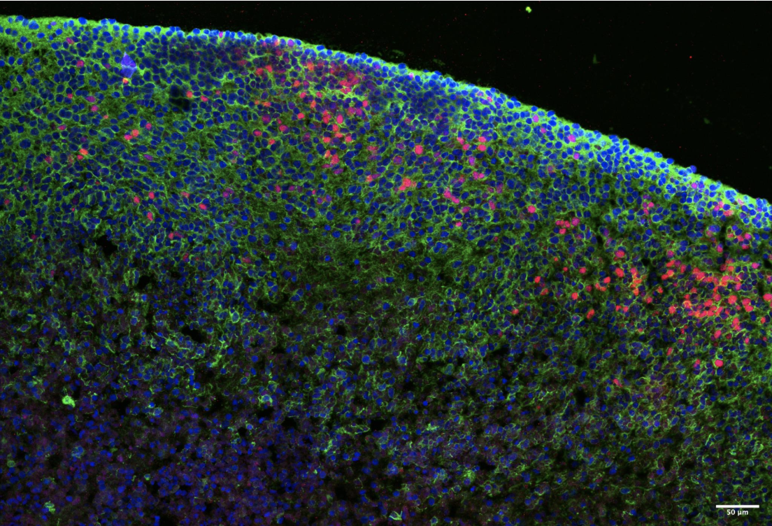 Organoid characterization after 50 days of maturation by immunostaining of fixed frozen tissue sections.