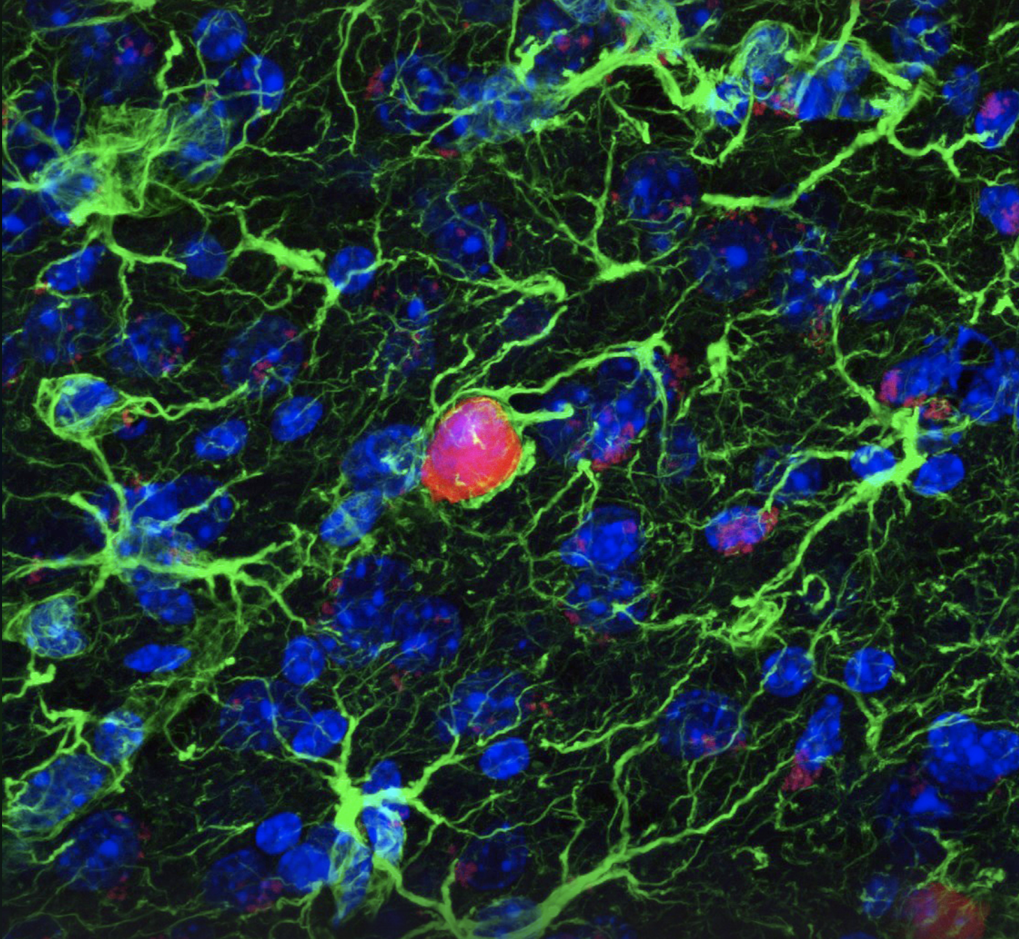 Microscopic view of neural tissue.