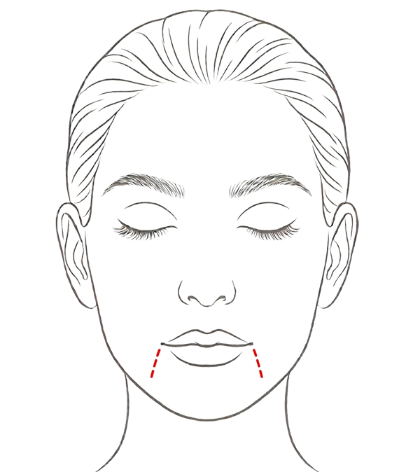Dropping Mouth Corners