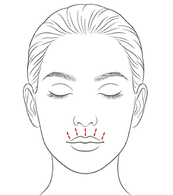 Perioral Lines