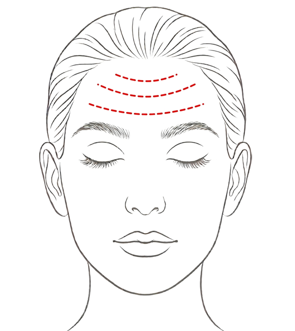 Horizontal Forehead Lines