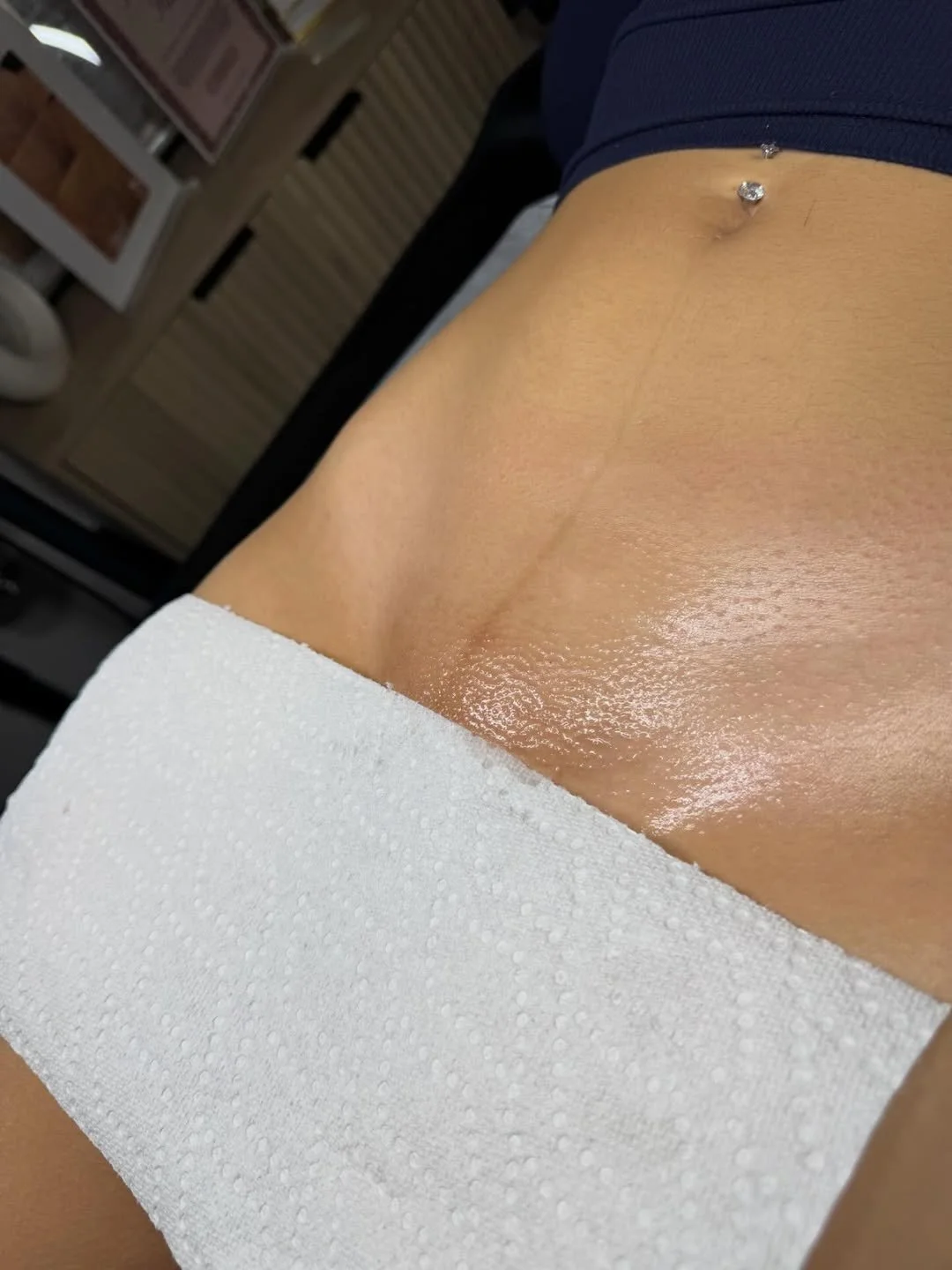 Close-up of a lower abdomen after a professional brazilian waxing treatment