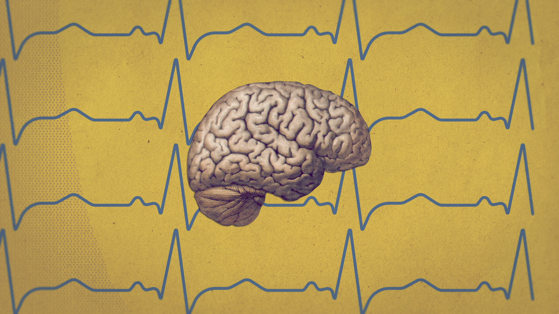 05_01m24_000s_brain-signals.png
