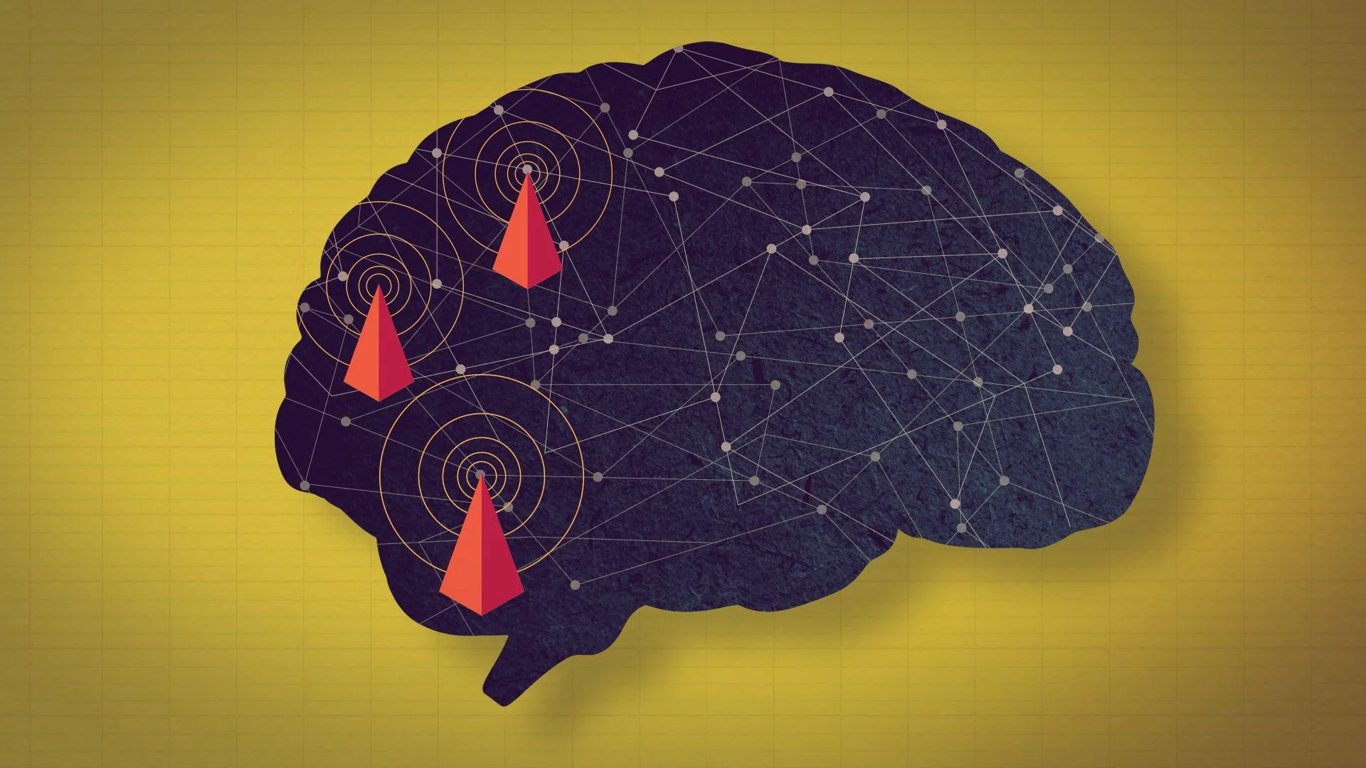 1401_1_A_Cytowic_Richard_10brain_YouTube_2.jpg